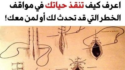 article