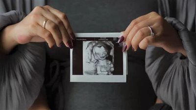 article